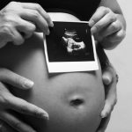 УЗИ при беременности: как правильно подготовиться